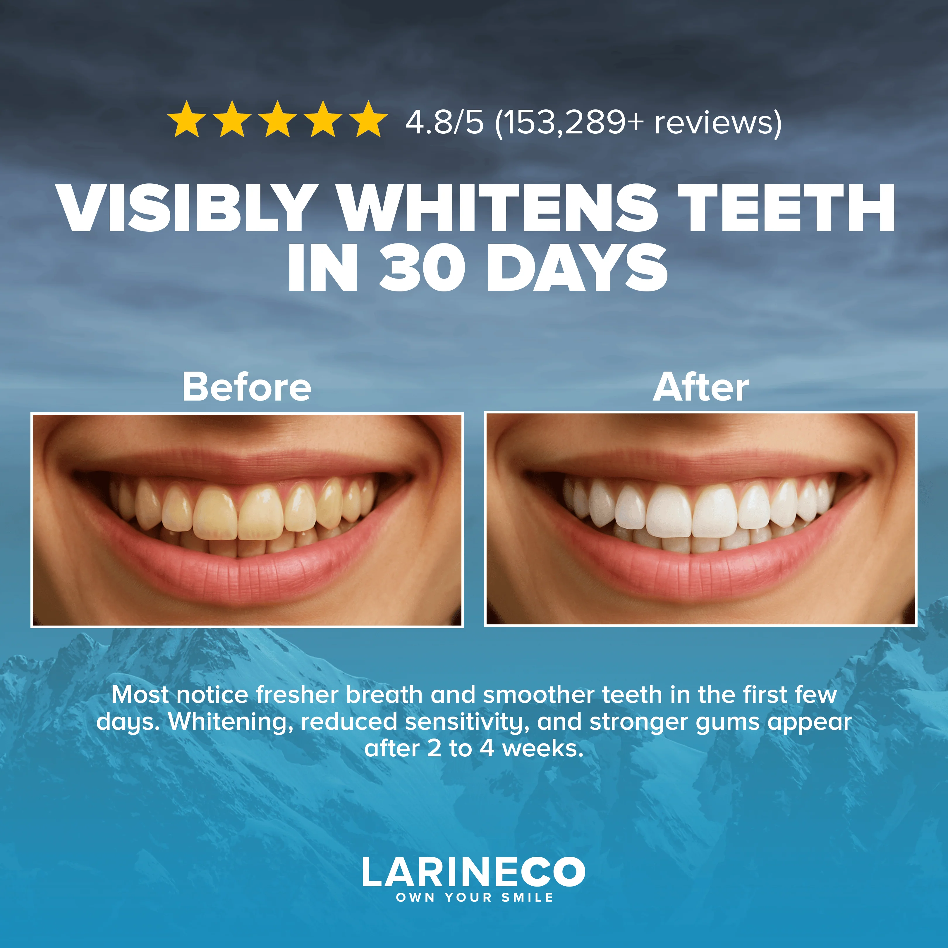Larineco™️ - Whitening Strips - Image 3